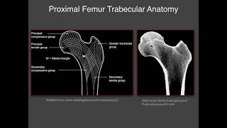 Imaging of hip [upl. by Nemzaj]