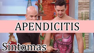 Síntomas de la apendicitis punzadas en el ombligo Peritonitis [upl. by Herra]