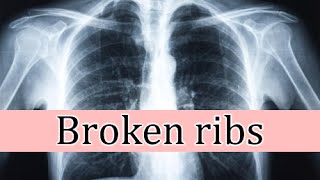 Broken ribs symptoms and treatment [upl. by Jobe]