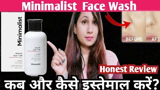 Minimalist SALICYLIC ACID Face wash Honest ReviewTreats Dark spotsacnepimplesSkincare2024 [upl. by Senecal36]