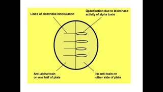 Lecithinase or Naglers Test [upl. by Coussoule]