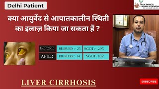 Recovery from Hyperbilirubinemia in Liver Cirrhosis  Ayurveda Emergency Treatment Success Story [upl. by Etana]