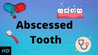 Abscessed tooth Causes SIgns and Symptoms Diagnosis and Treatment [upl. by Aaberg849]