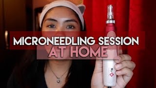 MICRONEEDLING THERAPY AT HOME My M DERMA PEN TUTORIAL  FABB LAGAS [upl. by Ainesell]