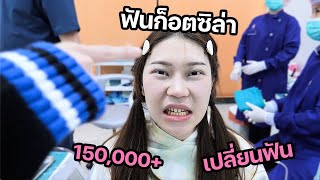 ฟันก็อตซิลล่า เปลี่ยนฟันใหม่หลักแสน 150000 ปากเหม็นเป็นขยะจริง [upl. by Retepnhoj]