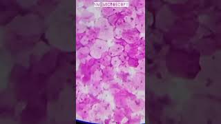 Squamous epithelial cells microscope slide🔬shortvideo youtube [upl. by Ellebasi]