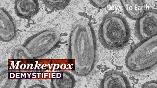 Monkeypox Demystified  Should we be worried about the new outbreak [upl. by Atener]