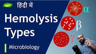 समझें Hemolysis कितनी तरह की होती है   Basic Science Series Hindi [upl. by Noevart]