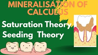 Theories of mineralisation of calculus  Periodontology [upl. by Reinnej853]