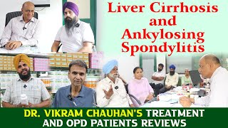 Liver Cirrhosis and Ankylosing Spondylitis  Dr Vikram Chauhans Treatment and OPD Patients Reviews [upl. by Lietman580]