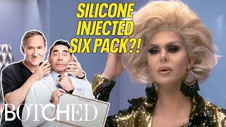 Botched Drag Race Queens Trinity The Tuck amp Detox  Botched  E [upl. by Colston421]