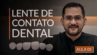 Como fazer lente de contato dental  Passo a Passo  aula 03 [upl. by Sidoeht608]