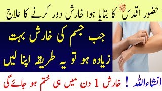 Kharish Ka Mukamal Ilaj  Kharish Khatam Karne ka Tarika  Tib e Nabvi  خارش کا علاج [upl. by Lexy]