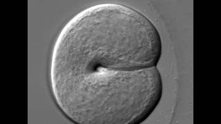 The first cell division of a ctenophore embryo [upl. by Thormora670]