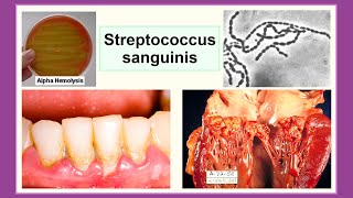 Streptococcus sanguinis [upl. by Mariska102]