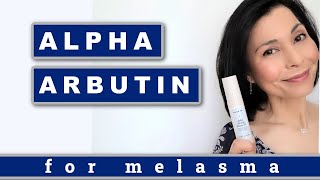 Alpha Arbutin For Treating Melasma [upl. by Calabresi]