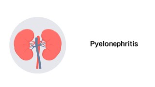 Nierenbeckenentzündung  Pyelonephritis Erkrankungen der Niere [upl. by Meihar]