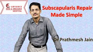 Subscapularis Repair made SimpleOrthopedic surgeons [upl. by Aritak]