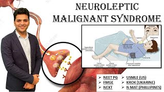 Q21 How Neuroleptic Malignant Syndrome present FMGENEXTUSMLENEETPGMRCPINICETAMC [upl. by Forrer832]