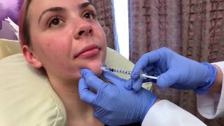 Botox for Chin Dimpling Preventing Wrinkles with Dr Michelle Ellern [upl. by Bach579]