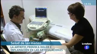 La ecografía para el diagnóstico de la artritis reumatoide [upl. by Behnken]