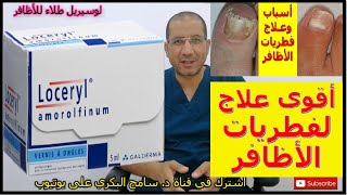 أقوى علاج لفطريات الأظافر لوسيريل طلاء للأظافر loceryl nail laquer [upl. by Daney]