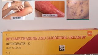 Betnovate C Cream Use Betnovate c cream review Composition Price and Side Effects in Hindi [upl. by Seafowl594]