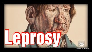 Pharmacology and treatment of Leprosy [upl. by Idieh]