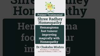 10 years amp 7 surgeries now Hemangioma improving with Homeopathy [upl. by Yup579]