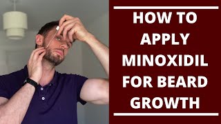 How to Apply Minoxidil for Beard Growth [upl. by Fennelly]