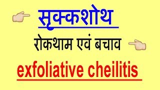 exfoliative cheilitis सृक्कशोथ रोकथाम एवं बचाव घरेलू उपाय [upl. by Ytte]