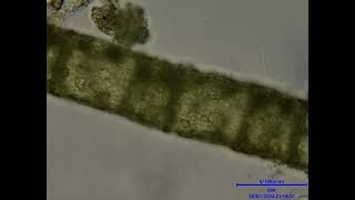 More Particles Inside Algae [upl. by Aisayn]