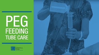 PEG Feeding Tube Care Instructions  Roswell Park Patient Education [upl. by Leahkim]