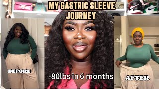 MY GASTRIC SLEEVE JOURNEY [upl. by Krock375]