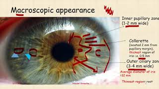 Anatomy of Uveal Tract  ophthalmology [upl. by Ettennek]