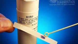 Microbiology oxidase test [upl. by Kalb]