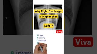 Diaphragm level  Diaphragm anatomy  MBBS  Anatomy  x ray  final year mbbs trending [upl. by Ravert]