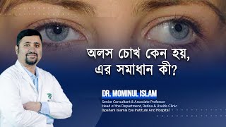 অলস চোখ কেন হয় এর সমাধান কী [upl. by Asyle]