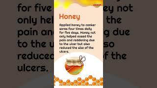 Natural Remedies To Cure Mouth Ulcers [upl. by Goraud]