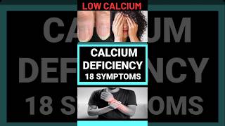 CALCIUM DEFICIENCY  18 SYMPTOMS [upl. by Romulus]