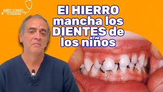 CUIDADO EL HIERRO MANCHA LOS DIENTES DE TU HIJO  Jairo Gomez Tu Pediatra [upl. by Fogg]