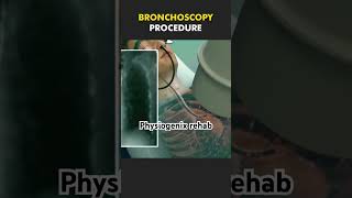 Bronchoscopy procedure shortsviral youtubeshort shortsfeed shortsyoutube youtubevideo youtuber [upl. by Bina887]