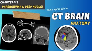 CT BRAIN Chapter 3 Parenchyma Internal capsule amp Deep Brain Nuclei Basal ganglia amp Thalamus [upl. by Enneiluj]