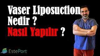 Vaser Liposuction nedir  Nasıl Yapılır [upl. by Dehsar]