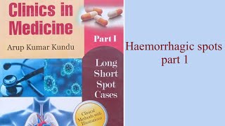 Haemorrhagic Spots part 1 [upl. by Eisak]