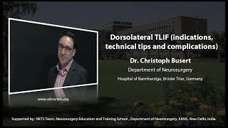 Dorsolateral TLIF Indication technical tips and complications [upl. by Suivatna462]