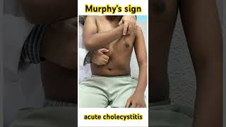 Murphys sign is a physical exam maneuver used to help diagnose acute cholecystitis [upl. by Iila796]