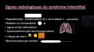 TFR  Différence entre le syndrome alvéolaire et interstitiel à la radiographie [upl. by Jewell54]