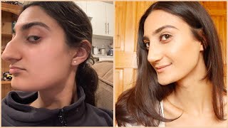 Doing My Make Up for the First Time Since my Nose Job 2 weeks Post Op [upl. by Adnauqal172]