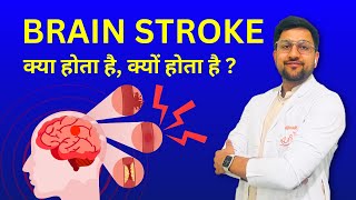 Stroke Kya Hota Hai Kaise Hota Hai Causes of Brain Stroke  Ischemic amp Hemorrhagic Stroke in Hindi [upl. by Sigismund]